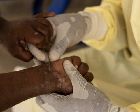 health officer handling an MPOX DISEASE PATENT