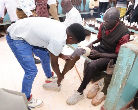 One of the over 100 amputees who benefited from the Kitale prosthetics outreach.